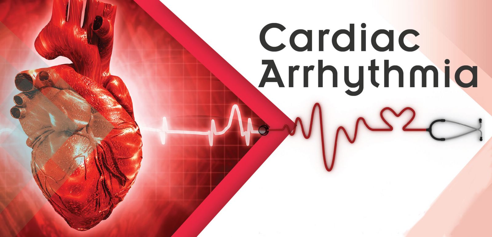 Natural Treatment For Cardiac Arrhythmia