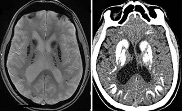 Researchers Undertake Challenge to Image Every Cell in the Human Brain at  Unprecedented Speed, Columbia